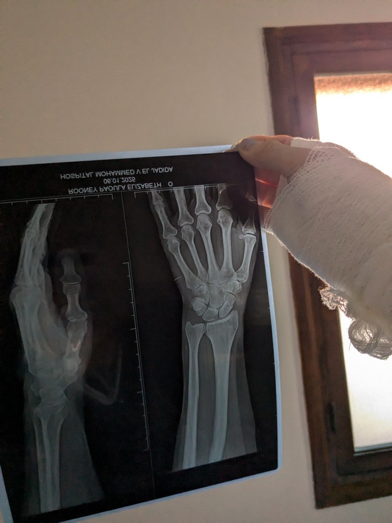 My X-ray: page 198